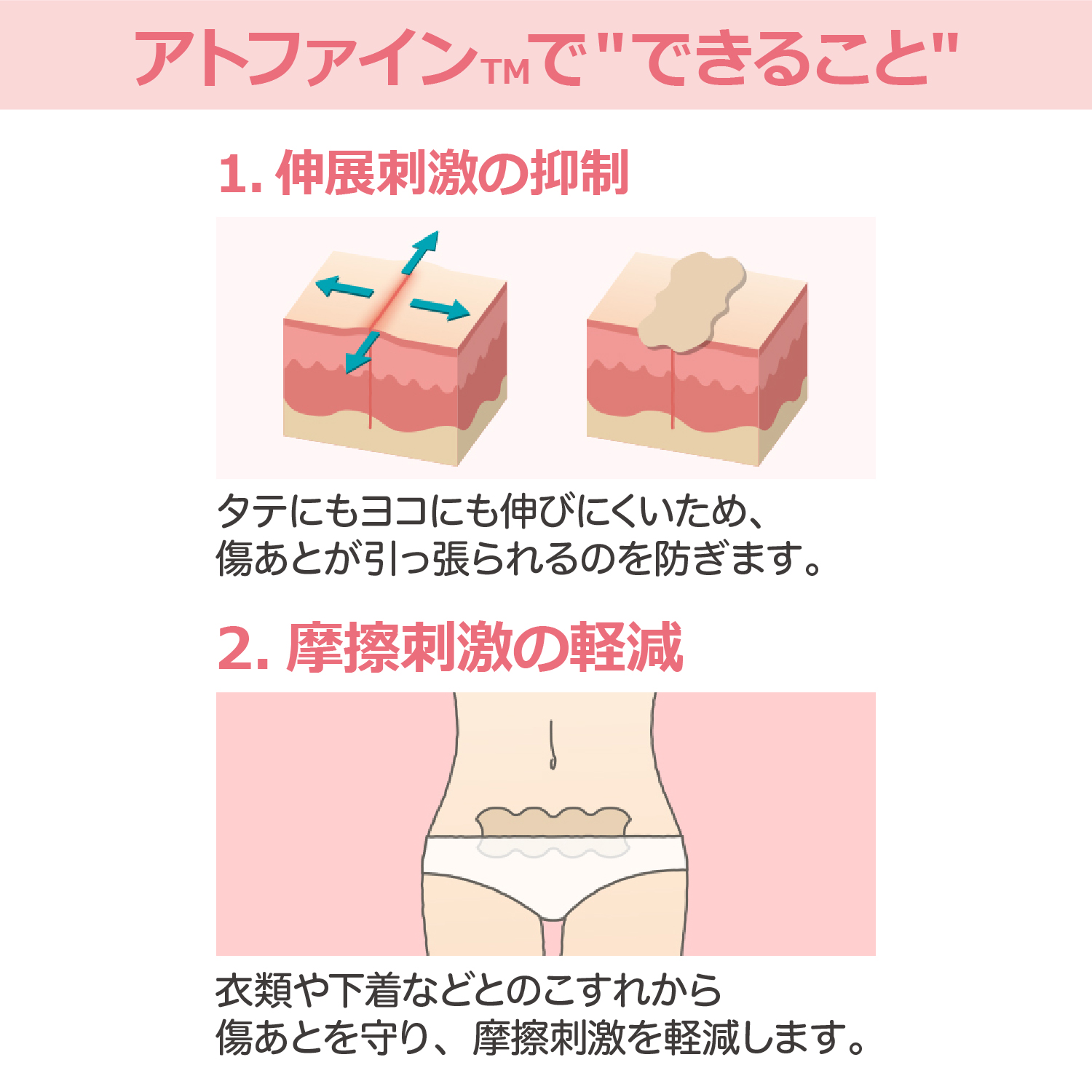 アトファイン LL 4枚