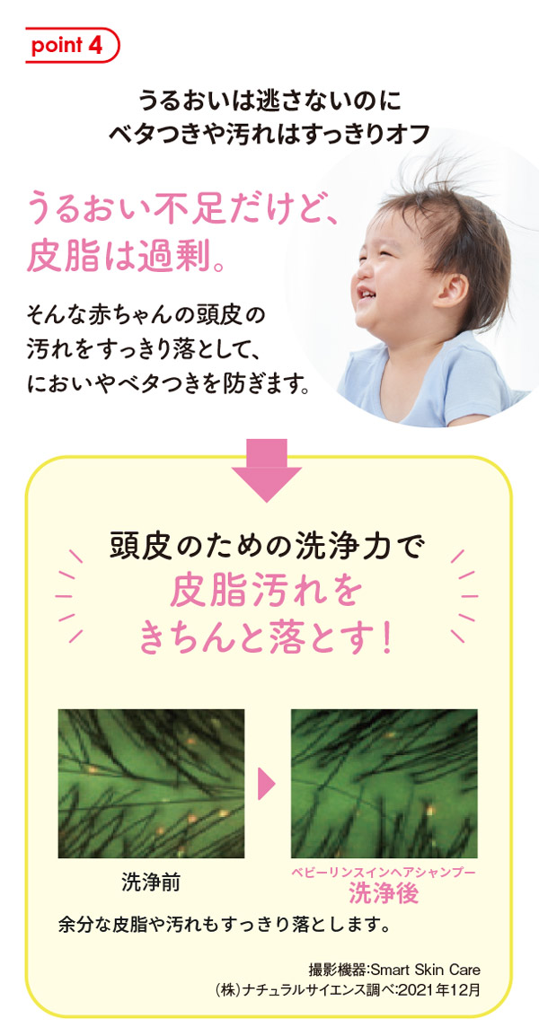 うるおいを守る成分で頭皮のバリア機能をサポート、頭皮のかゆみを予防する成分を配合