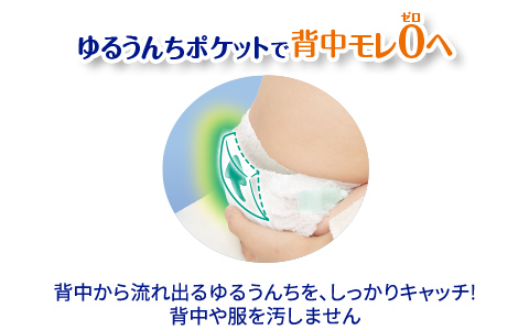 ゆるうんちポケットで背中モレ0へ